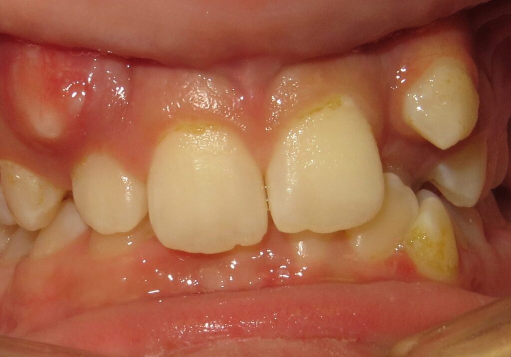 before and after | Orthodontic Teaching Institute