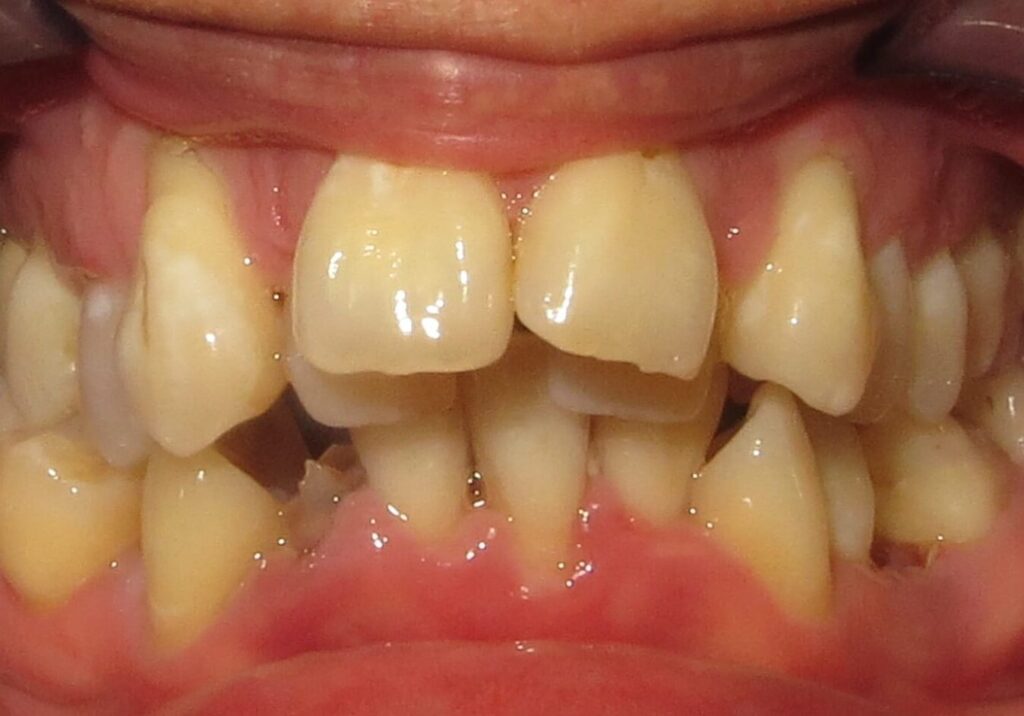 before and after | Orthodontic Teaching Institute